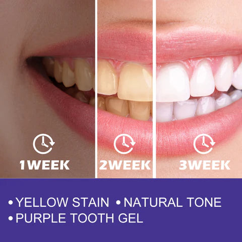 EELHOE PURPLE WHITENING TOOTHPASTE|معجون أسنان EELHOE المبيض باللون البنفسجي