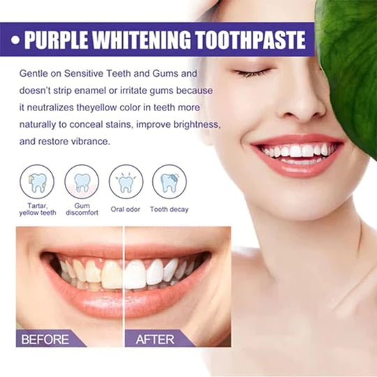 EELHOE PURPLE WHITENING TOOTHPASTE|معجون أسنان EELHOE المبيض باللون البنفسجي